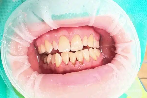 /