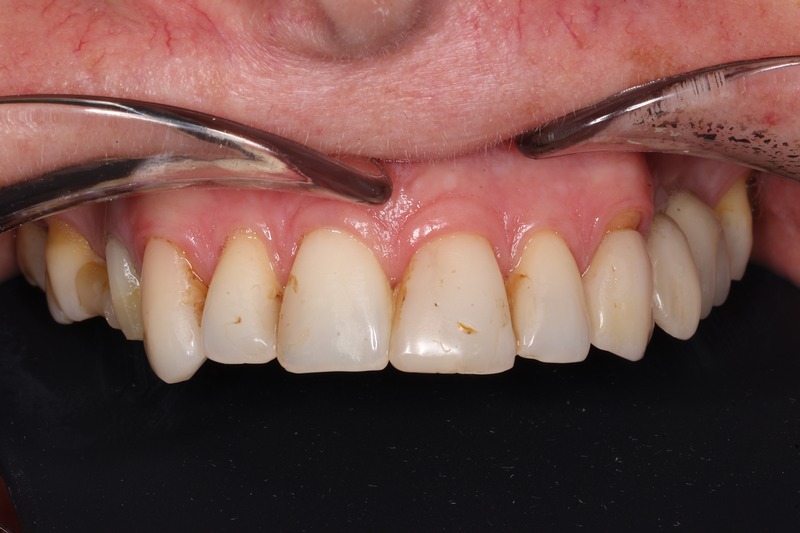 dentysta endodonta protetyka Bielany