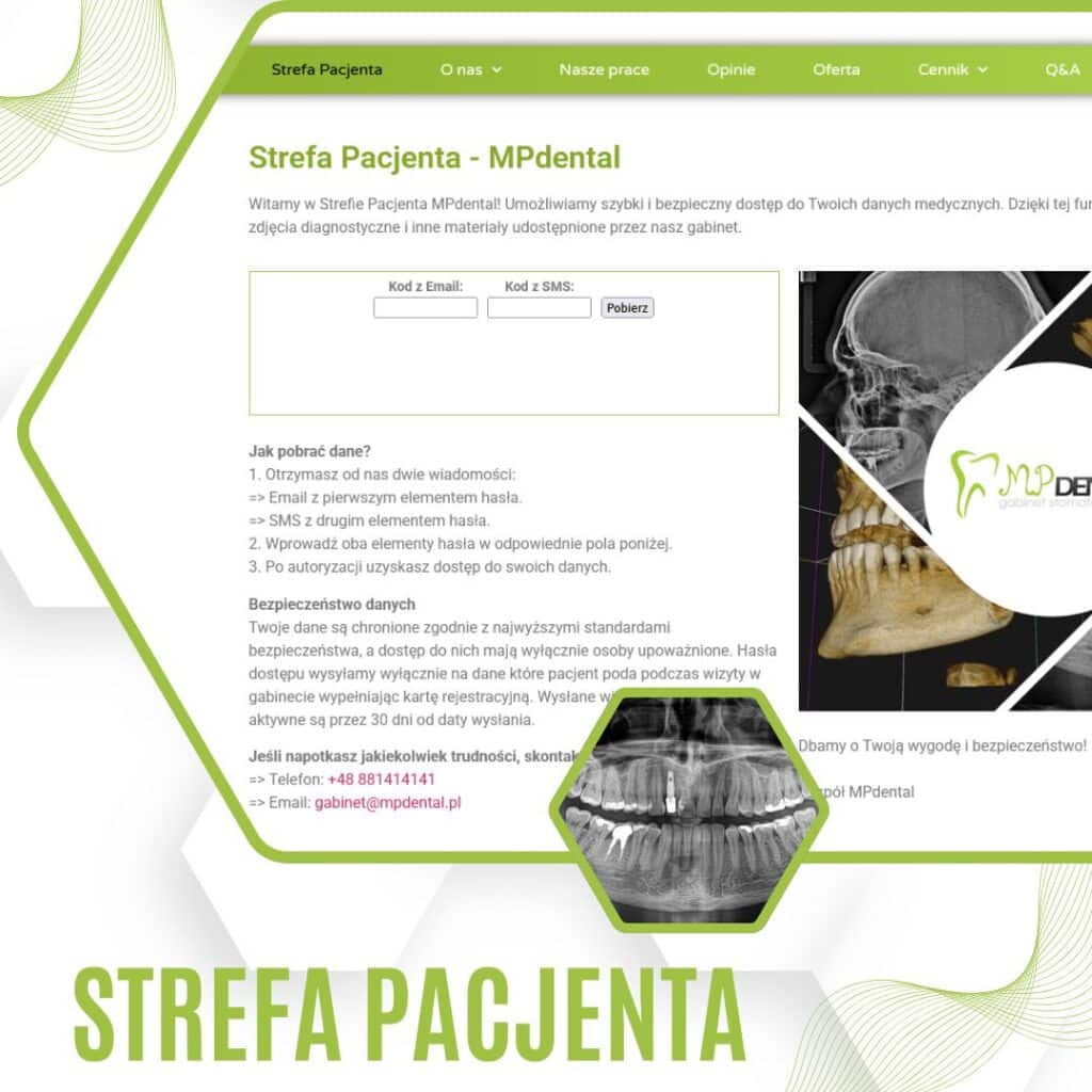 Nowoczesna stomatologia - MP-Dental - najlepszy dentysta na Bielanach