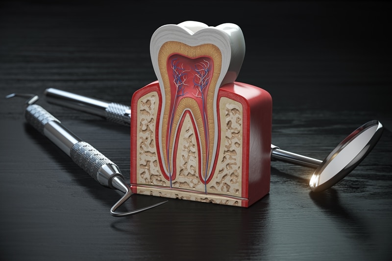 Paradontoza - zagrożenie dla uzębienia - MP-Dental - najlepszy dentysta na Bielanach
