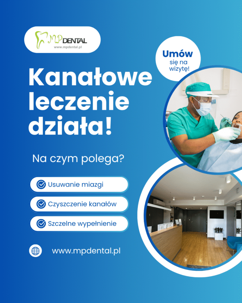 Leczenie kanałowe - MP-Dental - najlepszy dentysta na Bielanach