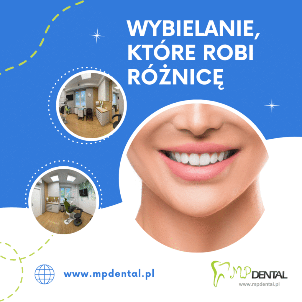 Biel zębów - MP-Dental - najlepszy dentysta na Bielanach