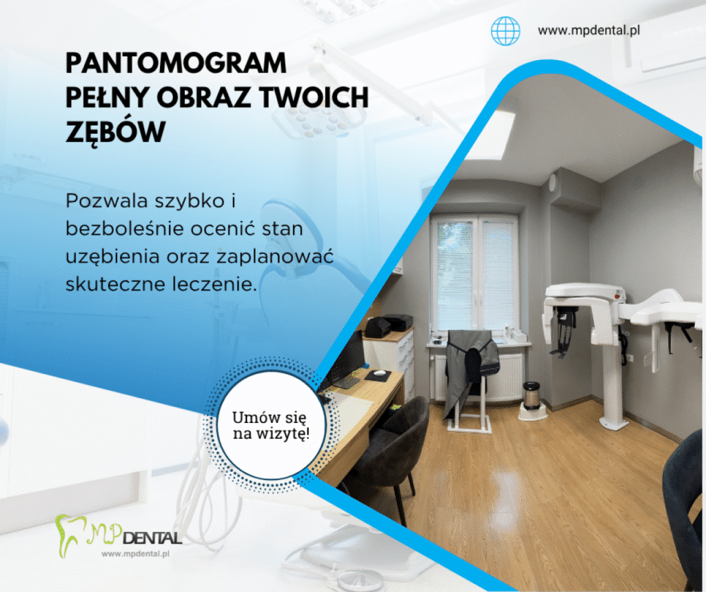 Pantomogram - MP-Dental - najlepszy dentysta na Bielanach