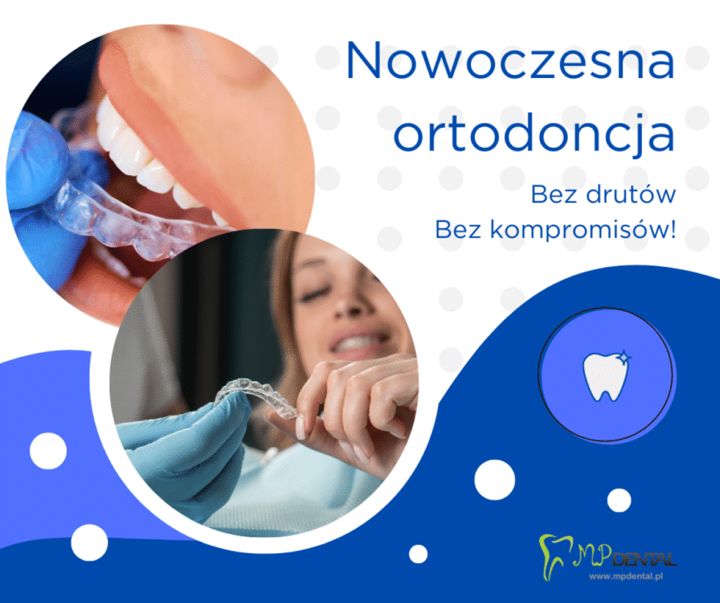 Nowoczesne leczenie ortodontyczne – skutecznie, komfortowo i dyskretnie - MP-Dental - najlepszy dentysta na Bielanach